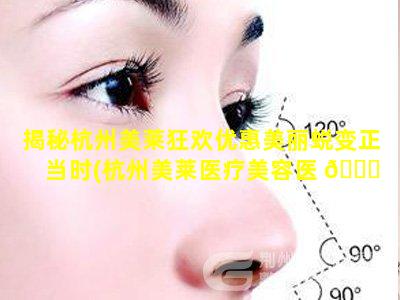 揭秘杭州美莱狂欢优惠美丽蜕变正当时(杭州美莱医疗美容医 🐕 院官网)